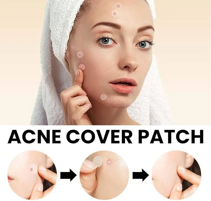 رقعة تغطية حب الشباب AcniFix™ (72 قطعة)