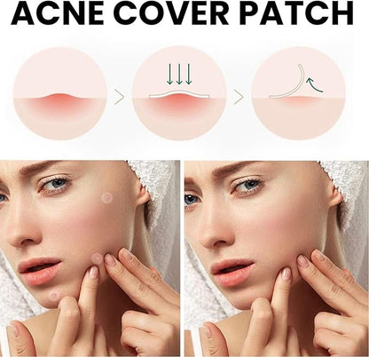 رقعة تغطية حب الشباب AcniFix™ (72 قطعة)