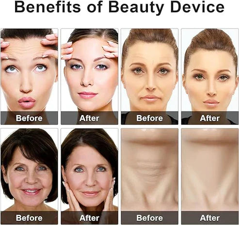 جهاز تجميل العيون - جهاز تجميل العيون